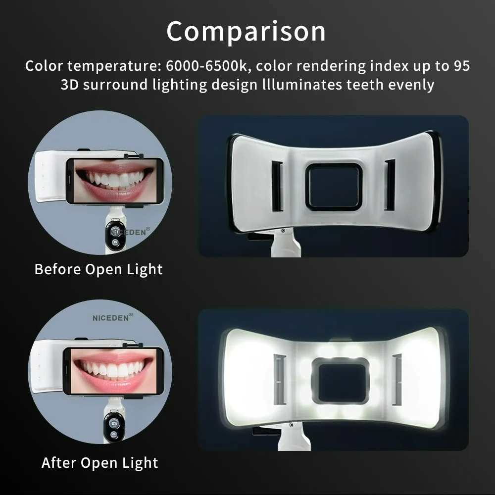 Luz de Fotografía Dental para  - Phone Accessories For Photography reseña y precio