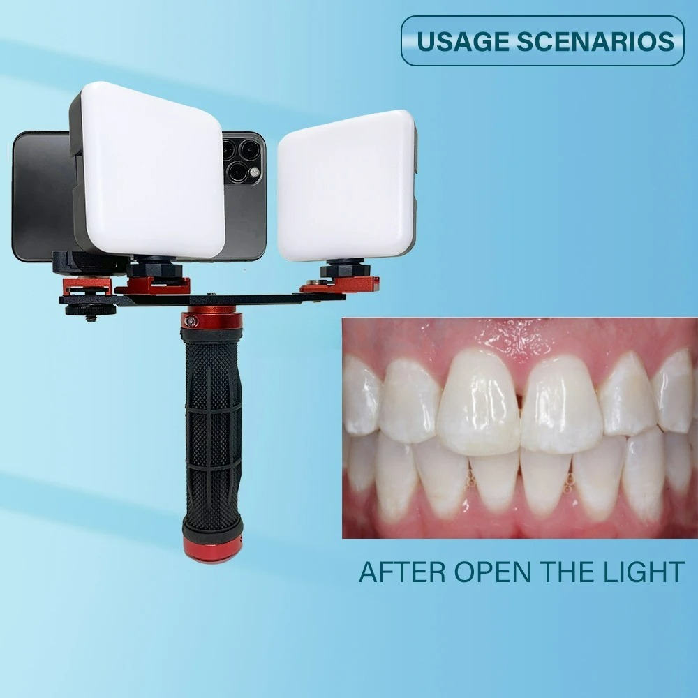 Luz de Fotografía Dental para  - Phone Accessories For Photography reseña y precio